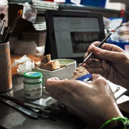 Laboratorio dental Alcobendas