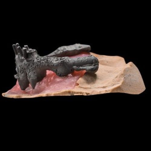 Madrid prótesis dental