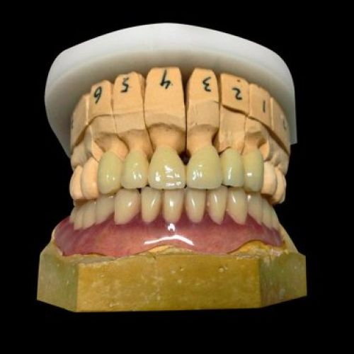 Laboratorio prótesis Madrid