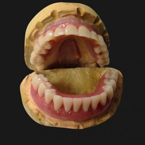 Madrid prótesis dental