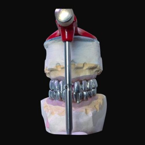 Laboratorio prótesis Madrid