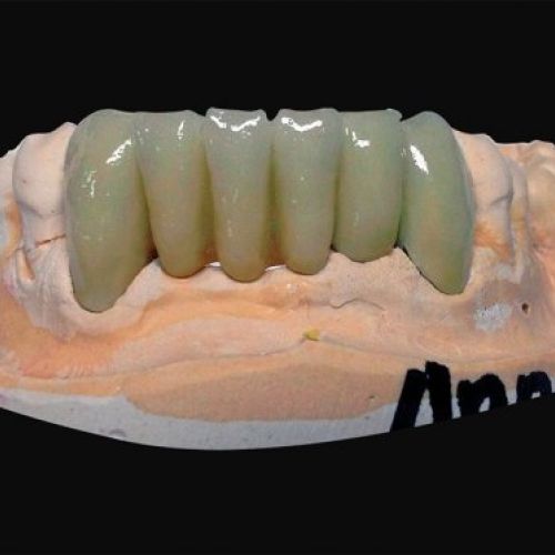 Laboratorio prótesis Madrid