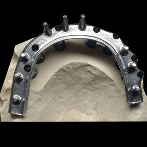 Laboratorio prótesis en Madrid