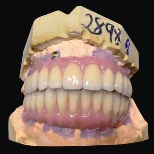 Laboratorio prótesis en Madrid